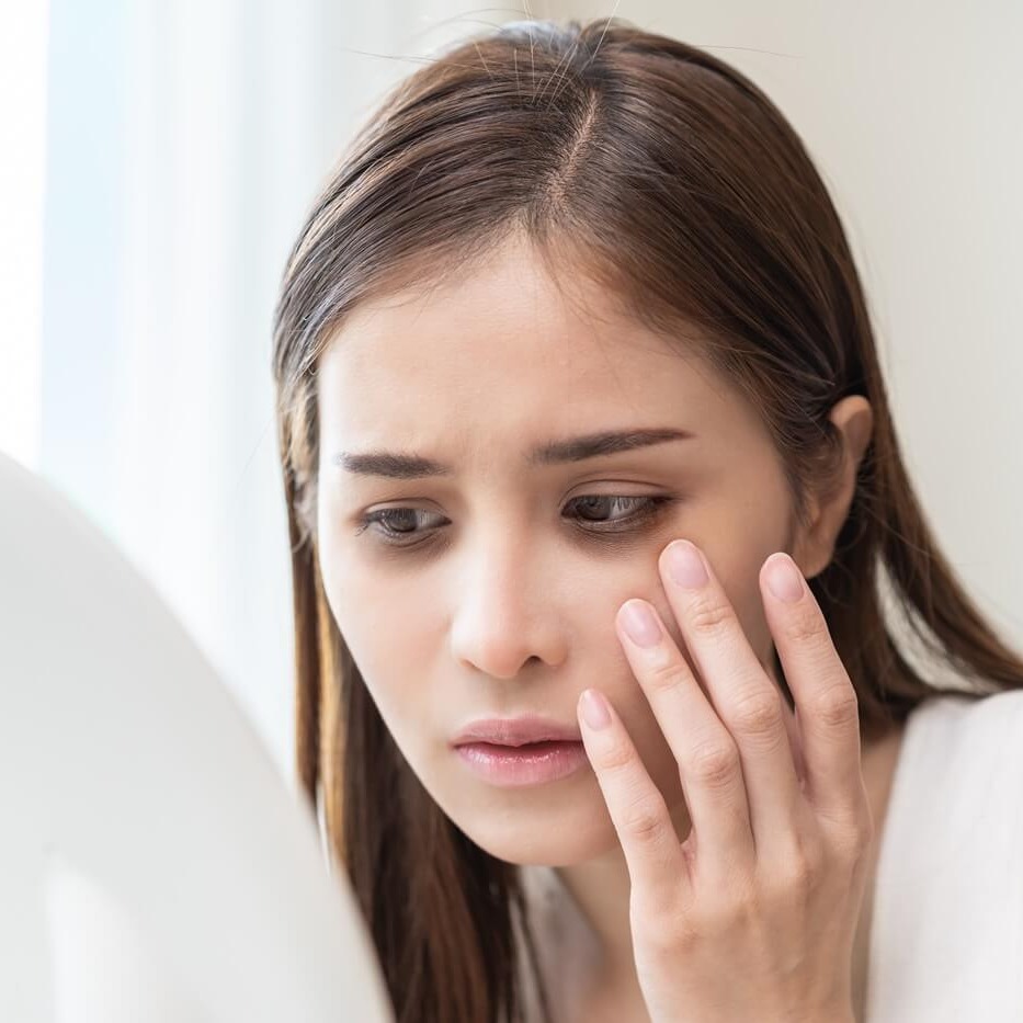 Jak rozjaśnić cienie pod oczami? Skuteczna pielęgnacja i triki makijażowe