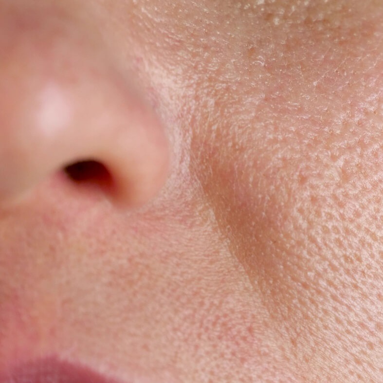 Sebum pod lupą - równowaga, nie walka