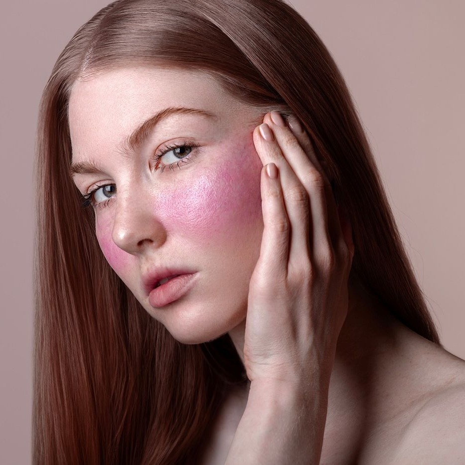 Cera naczynkowa – gdy skóra reaguje rumieniem i zaczerwienieniem