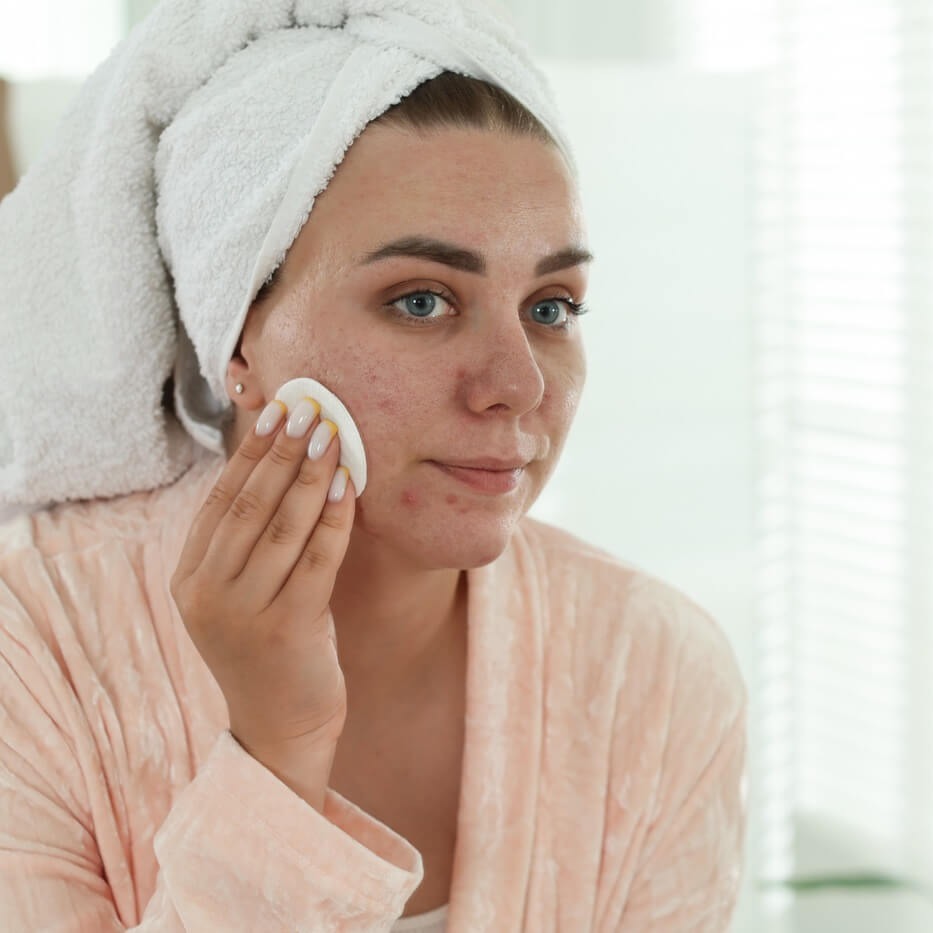 Trądzik dorosłych - co robić? 